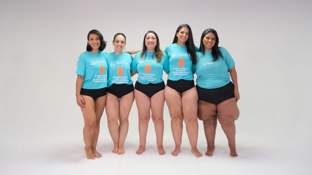 Como os Hormônios Afetam o Lipedema: Guia Completo