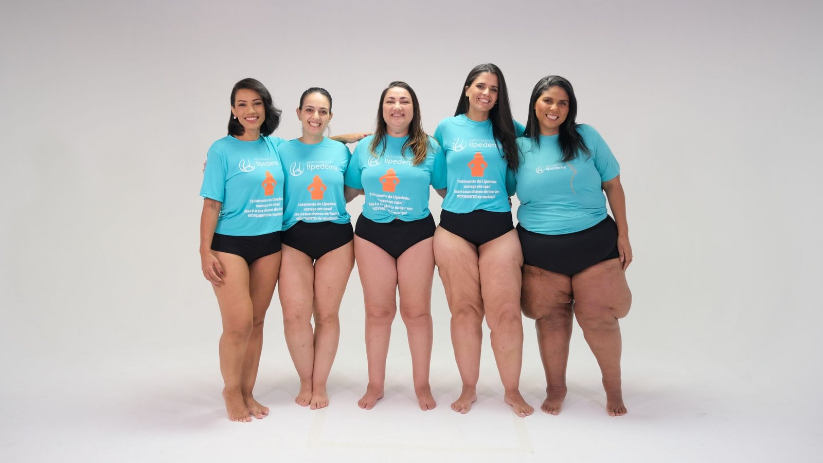 Como os Hormônios Afetam o Lipedema: Guia Completo