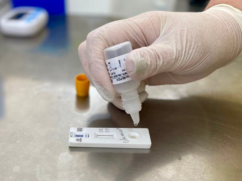 Acidentes com Material Biológico: Prevenção, Protocolo PEP e Cuidados Imediatos